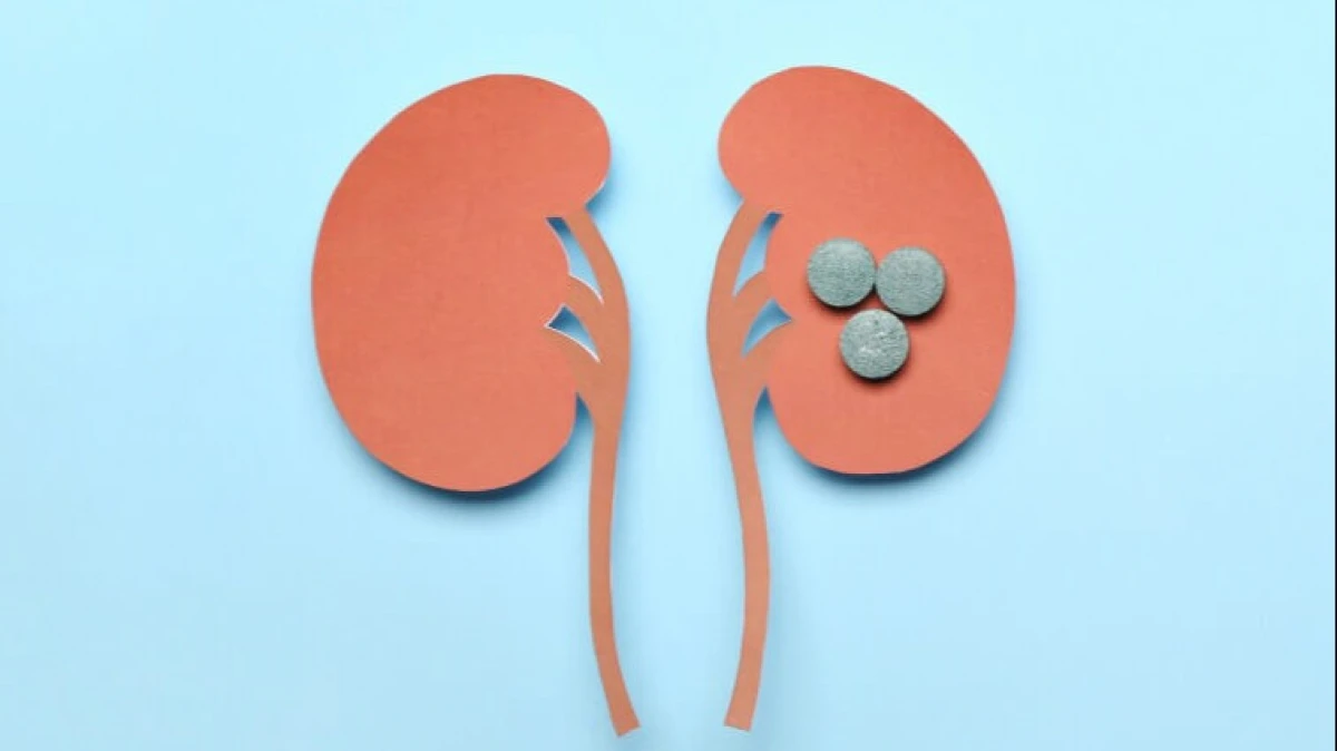 10 راهکار خانگی برای دفع سنگ کلیه