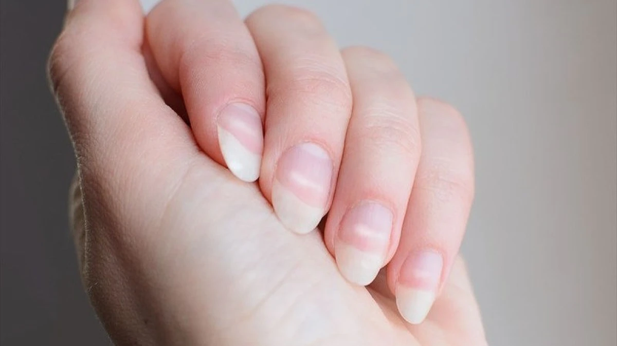 علت لکه‌های سفید روی ناخن و روش‌های درمان آن