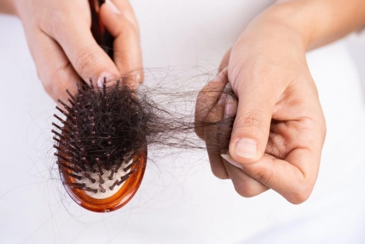 درمان ریزش موی زنان و مردان