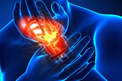 ضد التهاب طبیعی چیست؟