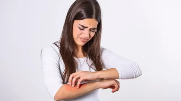 درمان‌های خانگی فوری و موثر برای خارش پوست بدن